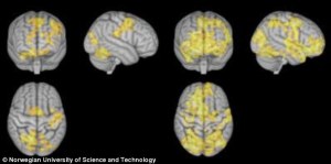 De vänstra bilder visar hjärnan under koncentrerande meditation, medan bilderna till höger visar hjärnan under icke-styrande meditation